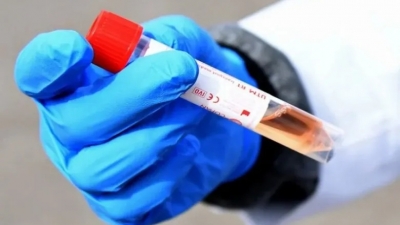 Հայաստանում արձանագրվել է կորոնավիրուսի նոր շտամի ենթատեսակ․ ԱՆ