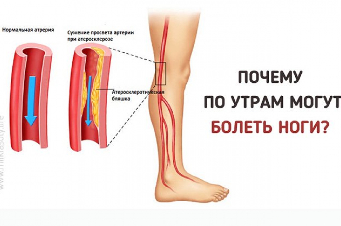 Сильные боли ноги ниже колена причины